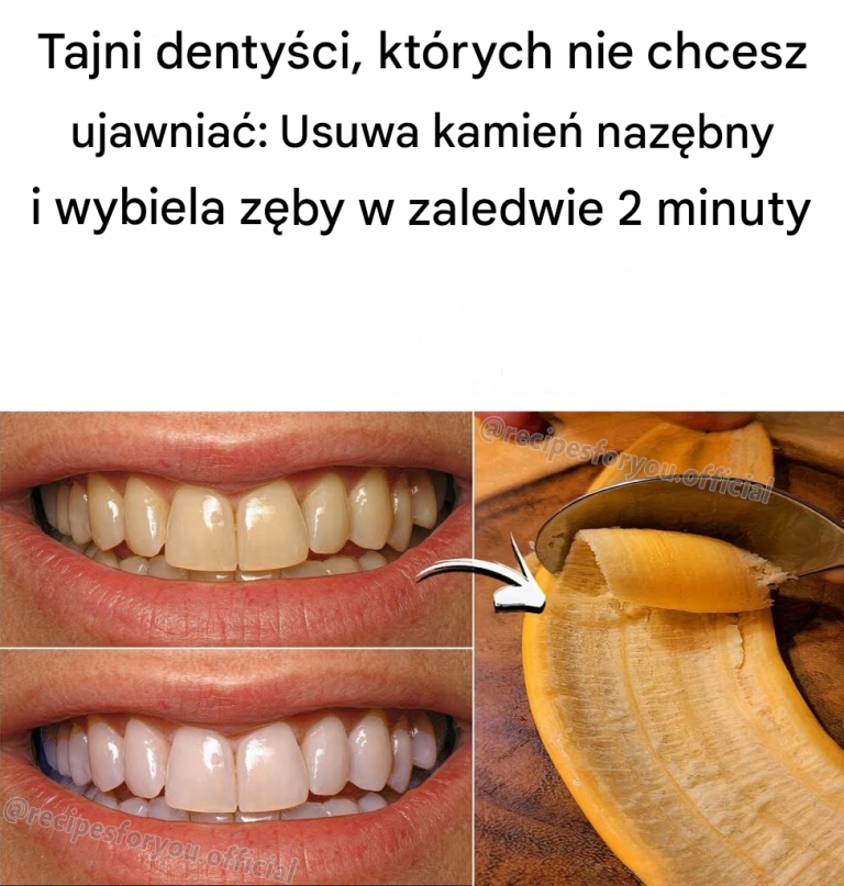 Tajemnica, której dentyści nie chcą, abyś poznał: Usuwa kamień nazębny i wybiela zęby w zaledwie 2 minuty