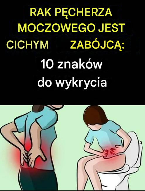 Rak pęcherza moczowego: cichy zabójca – 10 oznak, na które należy zwrócić uwagę