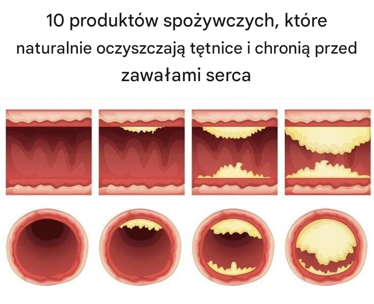 10 produktów spożywczych, które naturalnie oczyszczają tętnice i chronią przed zawałami serca