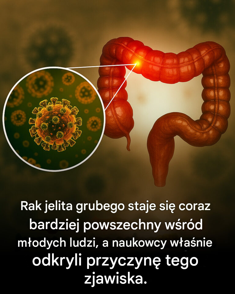 Naukowcy zidentyfikowali prawdopodobną przyczynę raka jelita grubego u młodych ludzi