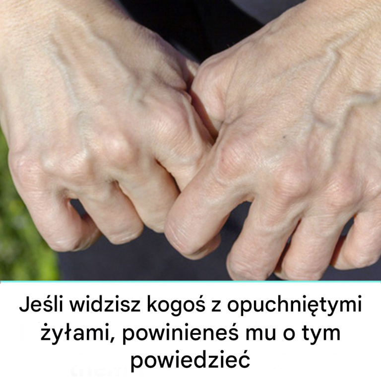 Daj mu znać jak najszybciej