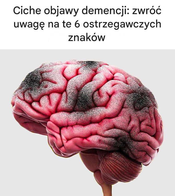 Ciche objawy demencji: zwróć uwagę na te 6 ostrzegawczych znaków