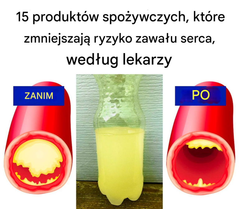 15 produktów spożywczych, które zmniejszają ryzyko zawału serca, według lekarzy