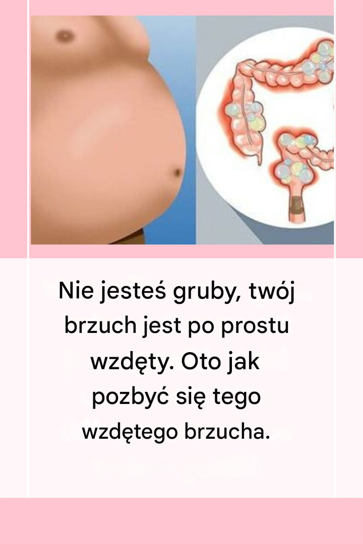 Nie jesteś gruby! Twój brzuch jest wzdęty i oto jak się go pozbyć!