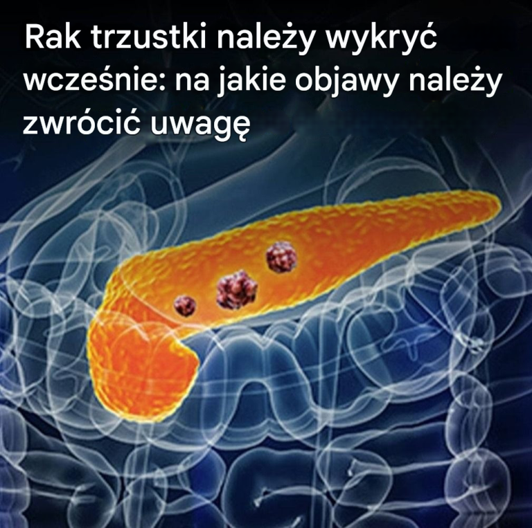 10 oznak raka trzustki, których nie należy ignorować