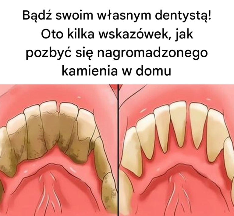 Bądź swoim własnym dentystą! Oto kilka wskazówek, jak usunąć kamień nazębny w domu