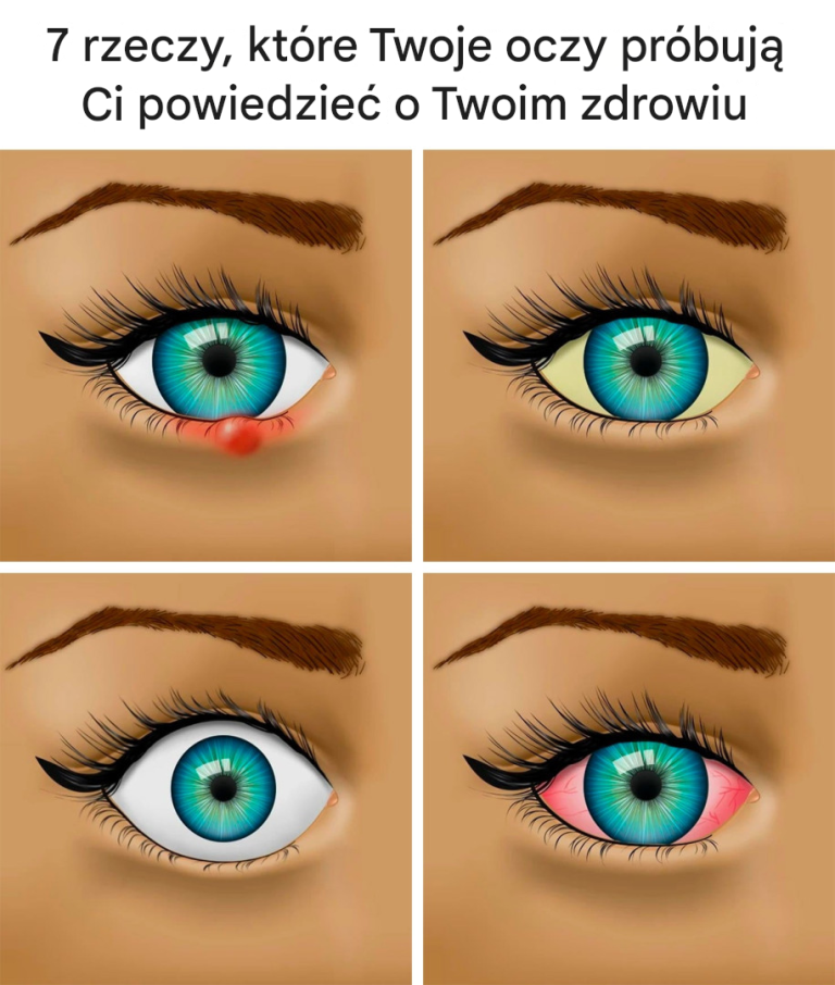 7 rzeczy, które Twoje oczy próbują Ci powiedzieć o Twoim zdrowiu