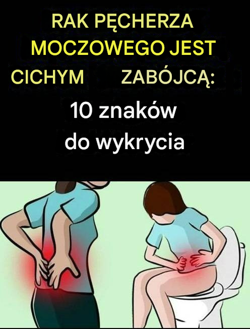 Rak pęcherza moczowego: cichy zabójca – 10 oznak, na które należy zwrócić uwagę