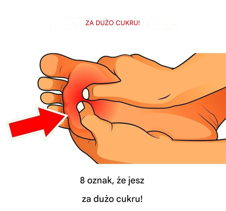 8 oznak, że jesz za dużo cukru!