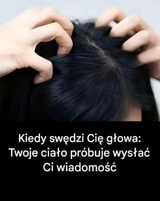 Swędząca głowa? Oto główne przyczyny