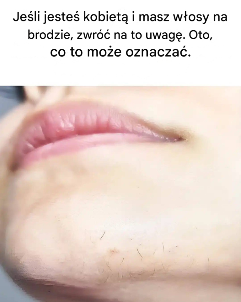 Włosy na brodzie u kobiet: co to oznacza?