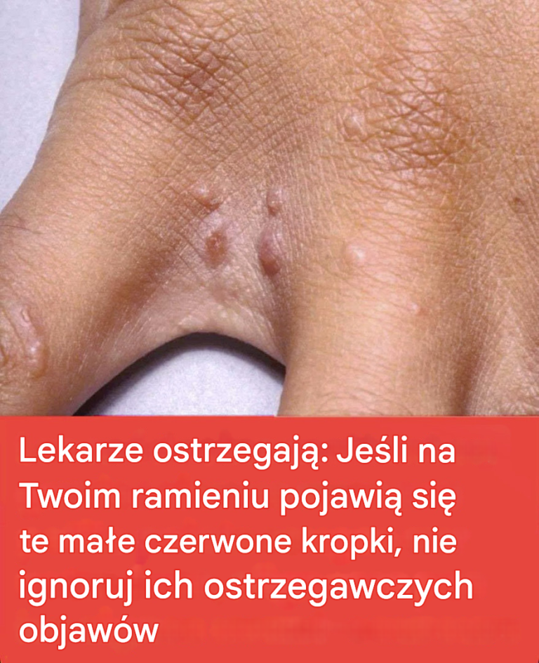 Nie ignoruj ​​tych małych czerwonych plamek na ramieniu – mogą być poważnym sygnałem ostrzegawczym.