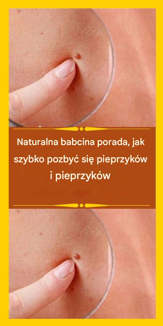 Naturalna babcina porada, jak szybko pozbyć się pieprzyków i pieprzyków