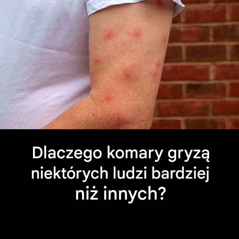 Dlaczego komary gryzą niektórych ludzi bardziej niż innych?