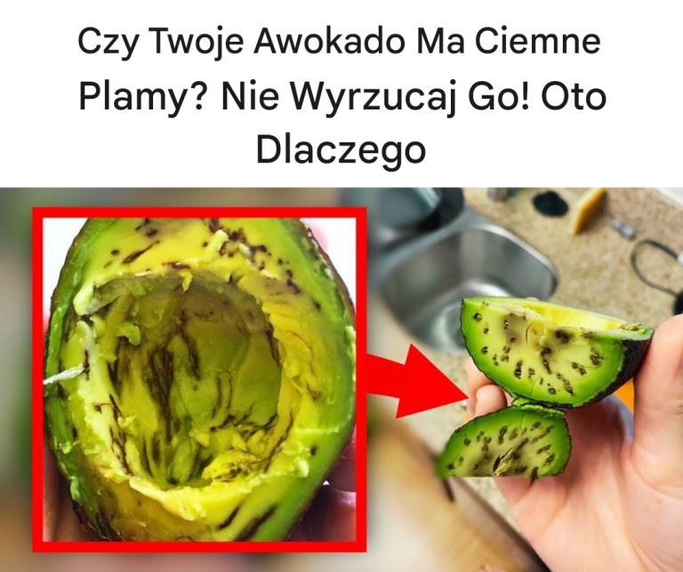 Czy Twoje Awokado Ma Ciemne Plamy? Nie Wyrzucaj Go! Oto Dlaczego