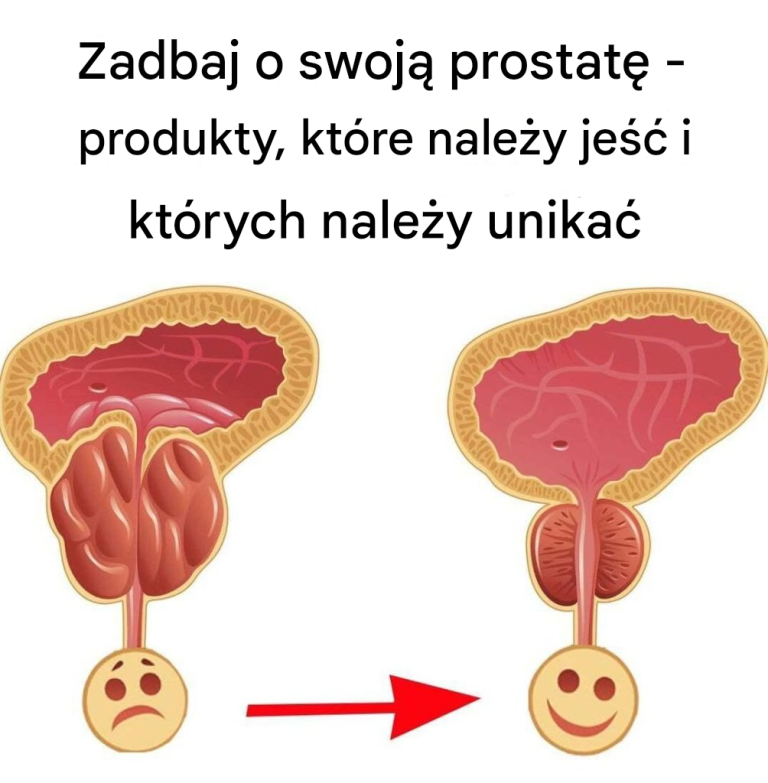 Zadbaj o swoją prostatę – produkty, które należy jeść i których należy unikać