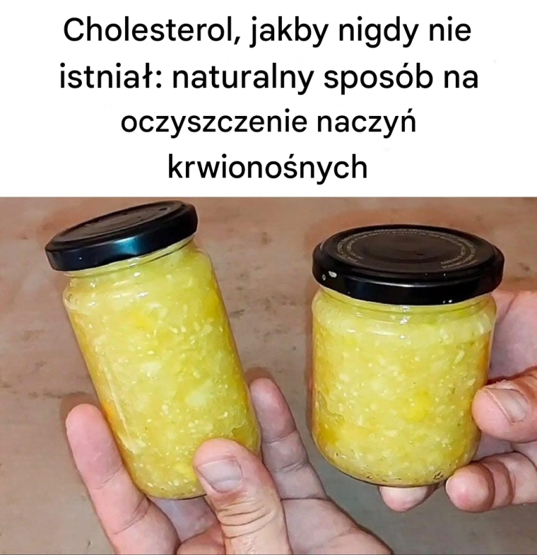 Cholesterol, jakby nigdy nie istniał: naturalny sposób na oczyszczenie naczyń krwionośnych