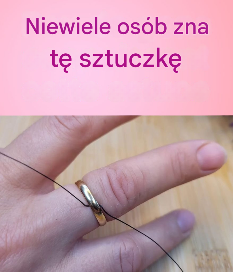 Lekarz pokazał mi, jak zdjąć pierścionek, który utknął mi na palcu