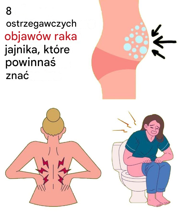 8 ostrzegawczych objawów raka jajnika, których nie należy ignorować