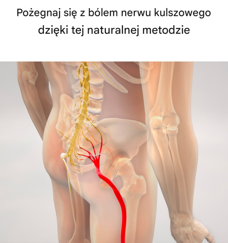 Pożegnaj się z bólem nerwu kulszowego dzięki tej naturalnej metodzie
