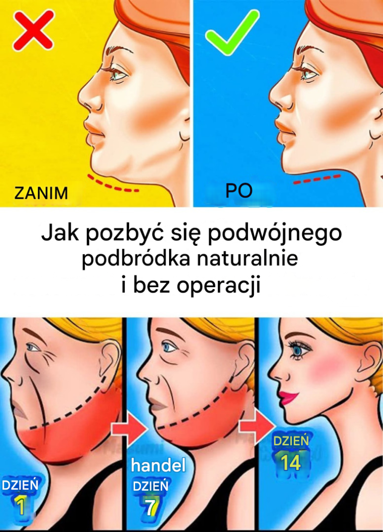 Jak pozbyć się podwójnego podbródka?