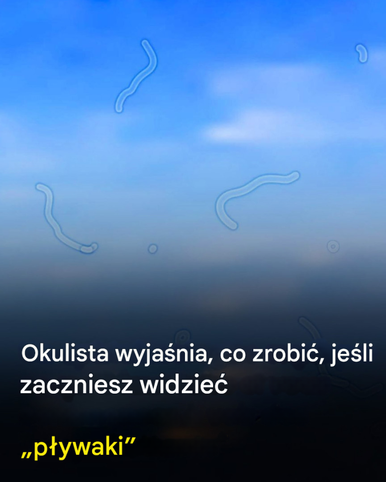 Co to są męty? Oto co zrobić, jeśli je zobaczysz