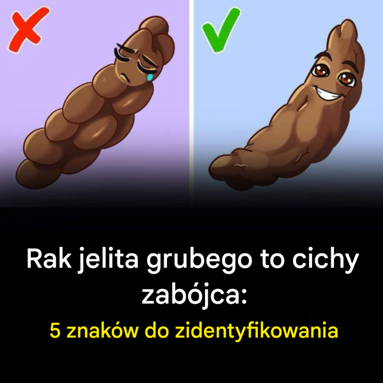 5 oznak raka jelita grubego