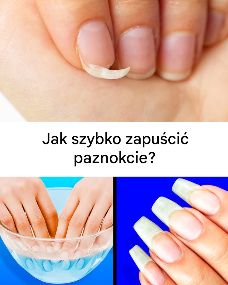 Jak przyspieszyć wzrost paznokci?