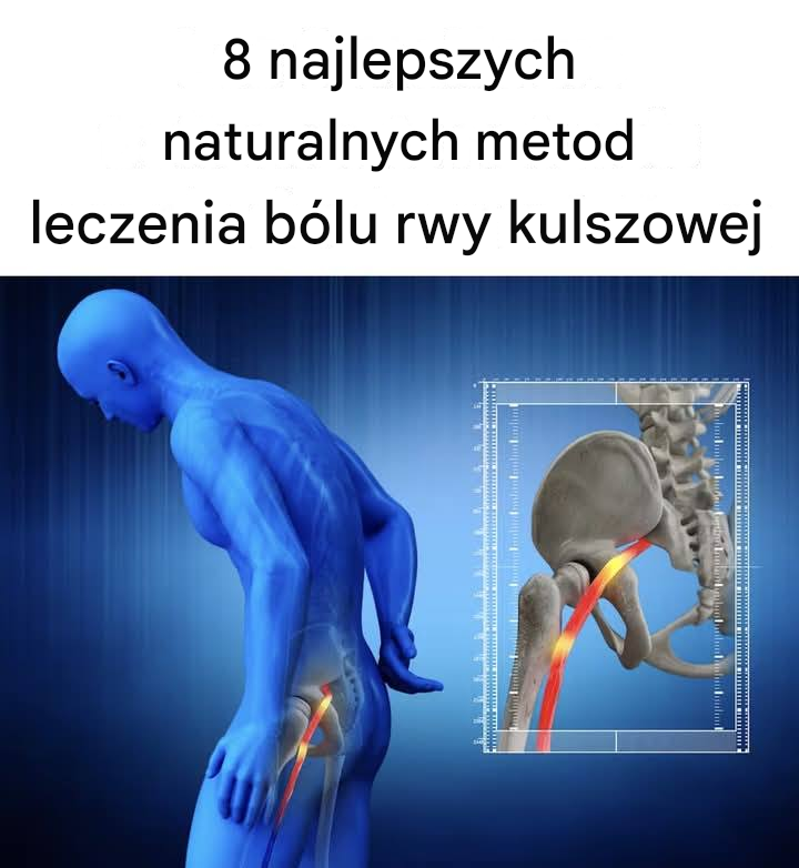 8 sposobów na ból rwy kulszowej, które musisz wypróbować, zanim włożysz do ust kolejny środek przeciwbólowy