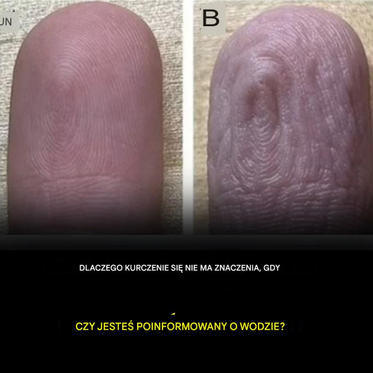 Dlaczego palce marszczą się, gdy zanurzysz je w wodzie?