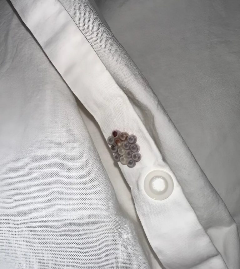 Odrażające znalezisko w Twoim łóżku: Co to były te dziwne kulki i jak się ich pozbyć?