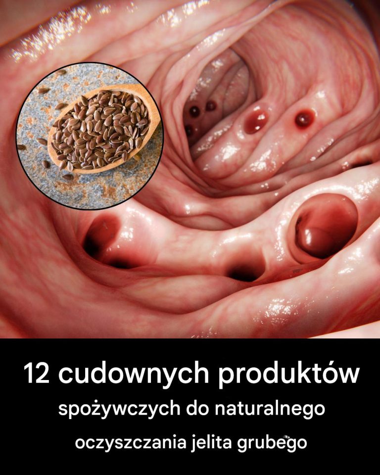 12 superproduktów, które naturalnie oczyszczą Twoje jelito grube