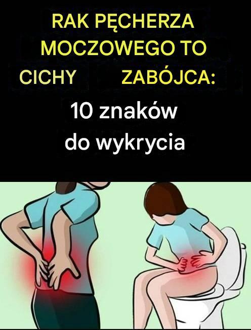 Rak pęcherza moczowego: cichy zabójca – 10 objawów, na które należy zwrócić uwagę