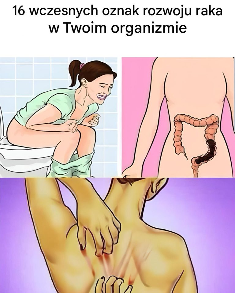 16 ostrzegawczych objawów raka