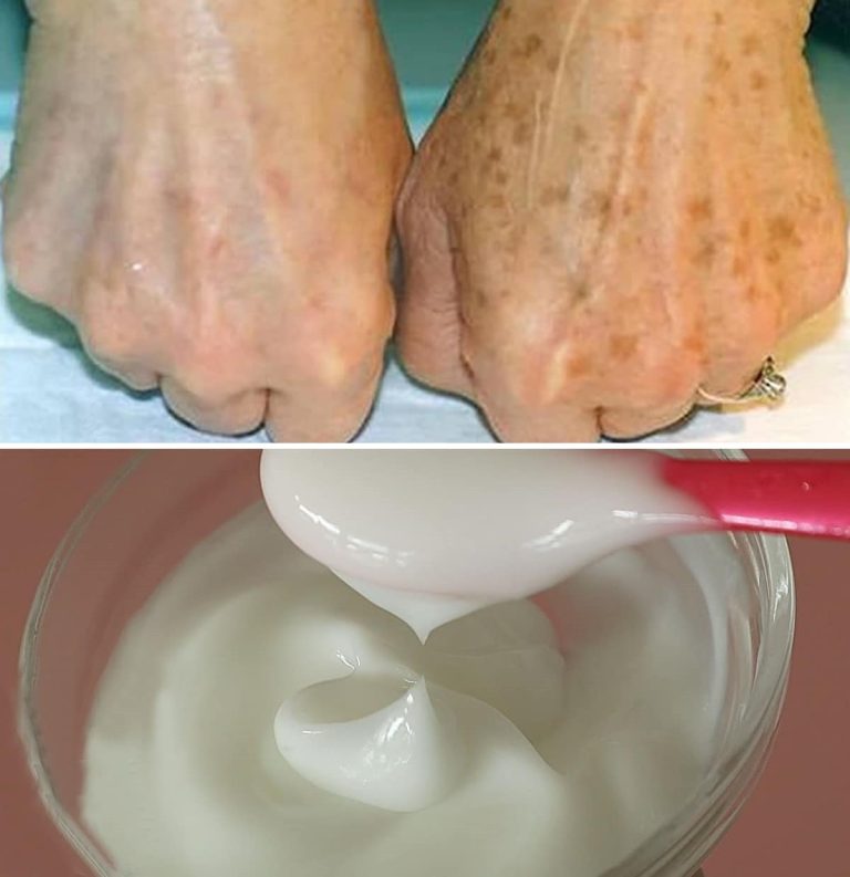 Jak błyskawicznie pozbyć się niedoskonałości i zmarszczek z dłoni