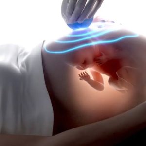 Idealny czas na macierzyństwo: kluczowe pytanie