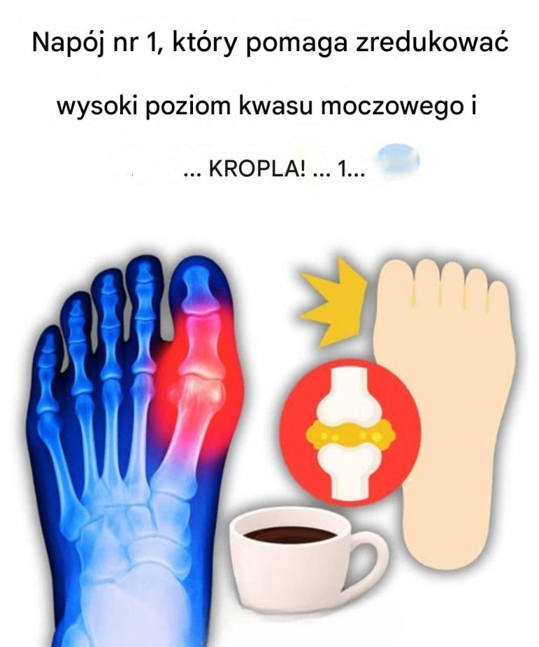 „Mój duży palec u nogi płonął… Dopóki nie odkryłem tych 5 napojów, które naturalnie eliminują kwas moczowy!”