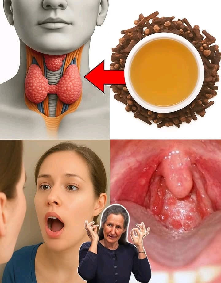 🛡️ Goździki: Mały uzdrowiciel natury dla spokojnego gardła i szczęśliwego ciała