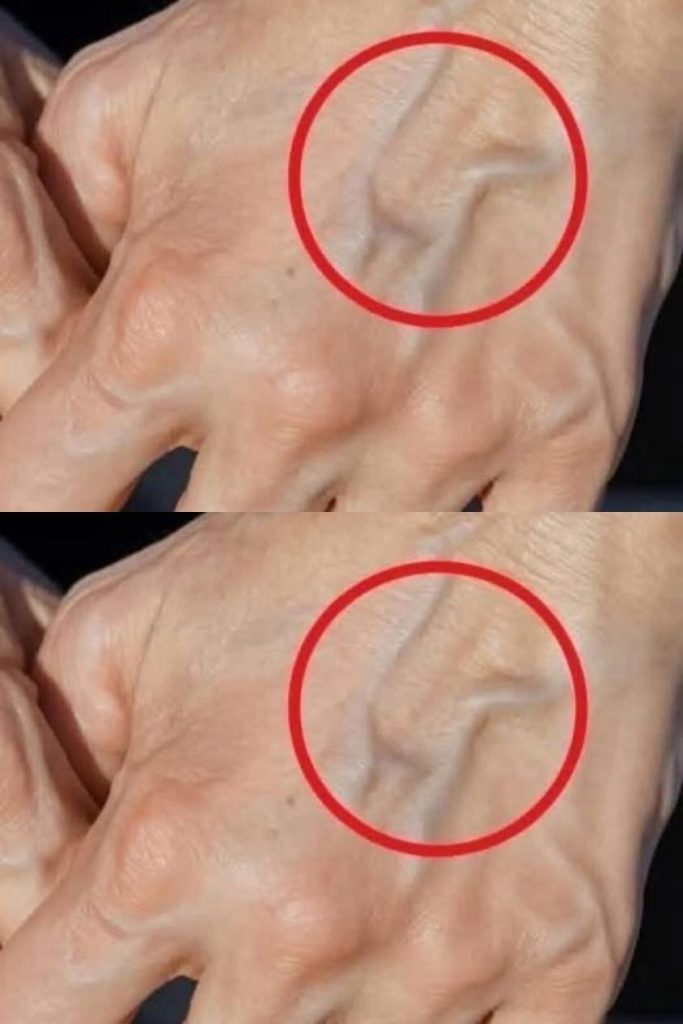 Naturalne środki zaradcze w celu poprawy zdrowia żył i skóry