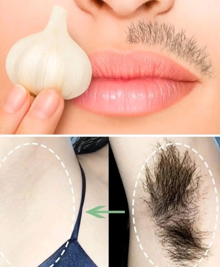 Naturalne usuwanie włosów, które faktycznie działa: prawda za czosnkiem i inne domowe środki zaradcze
