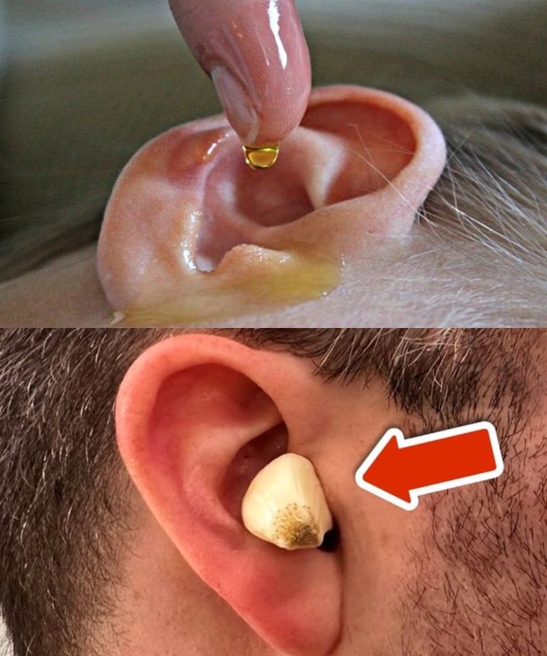 6 naturalnych środków na infekcję ucha