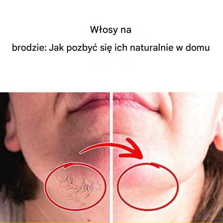 Usuwanie włosków z brody bez uszkadzania skóry: naturalne rozwiązanie