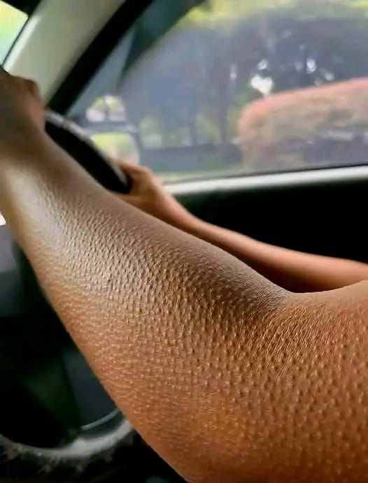 Jeśli Twoja Skóra Wygląda Tak, Oto, Co Naprawdę Oznacza