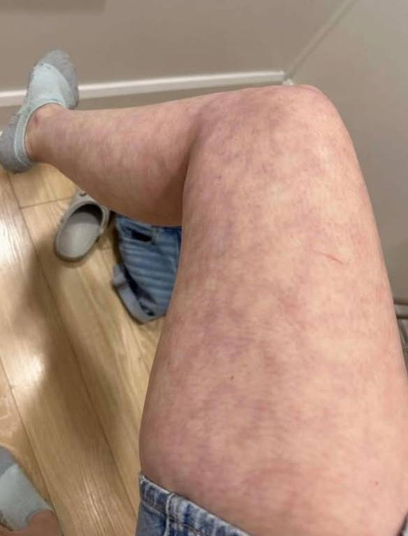 Oto konsekwencje spania z... Zobacz więcej