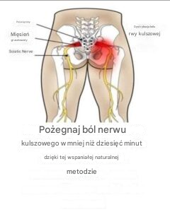 Pożegnaj się z Sciaciatic Nerve Pain w mniej niż dziesięć minut dzięki tej wspaniałej naturalnej metodzie