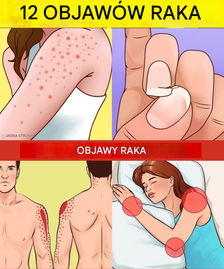 12 wczesnych znaków ostrzegawczych, że twoje ciało może rozwijać komórki nowotworowe