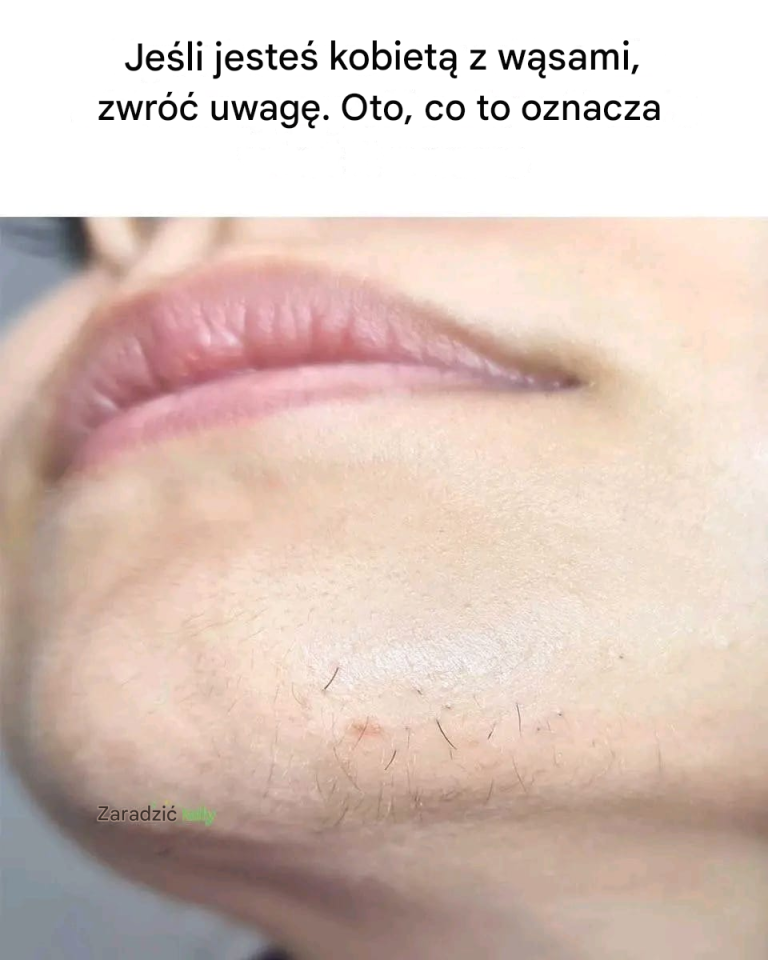 Co Chin Whiskers mogą powiedzieć Ci o twoim zdrowiu